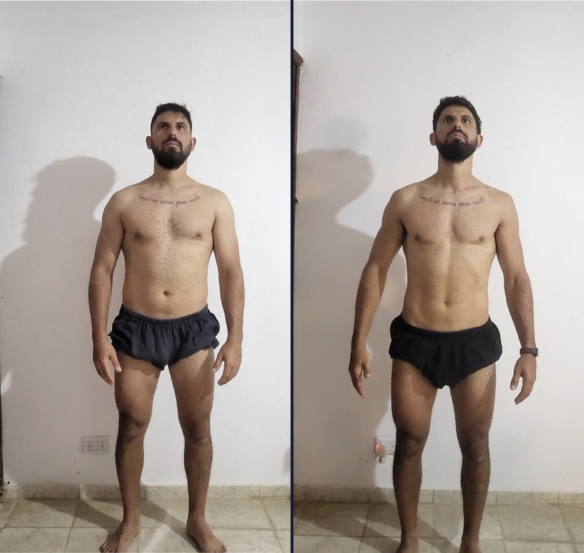 Martín — antes y después