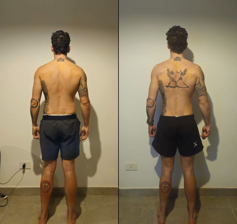 Martín O. — antes y después