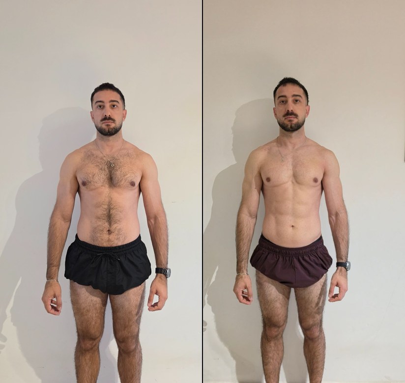 Nicolás — antes y después
